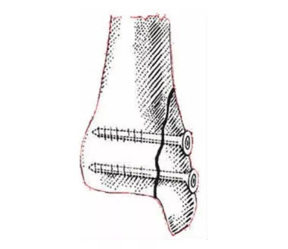 猫咪狗狗骨折了怎么办？扒一扒宠物“骨子里”的那些事