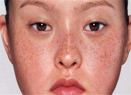 癌细胞|肝“癌变”时,“鼻子”出现这信号,八成肝内有癌细胞了,早就医!