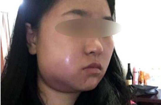 智齿是什么呢？到底要不要拔出？看完后恍然大悟