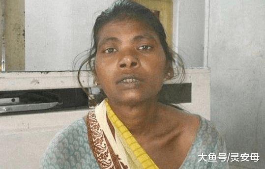 印度妇女的大腿内发现70根钢针，连医生都被吓坏了