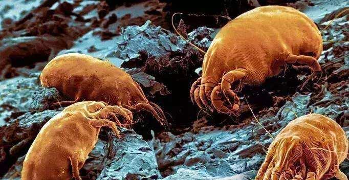 薇薇 脸上感染了螨虫, 会出现4现象, 教你1个最佳除螨攻略