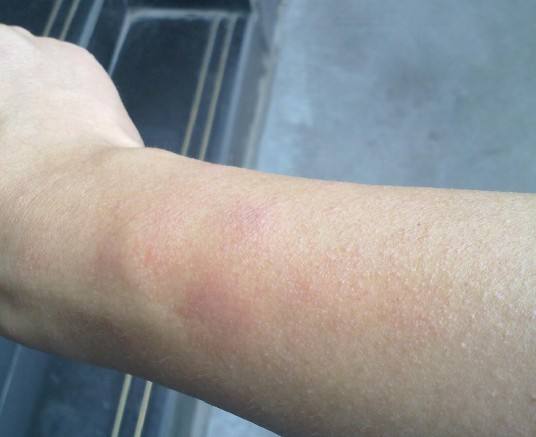 住进新家后，身体出现这些不适，说明甲醛已经伤害你的健康了！