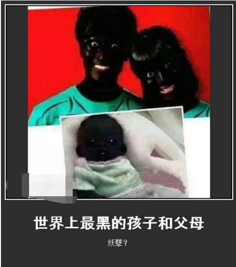 世界上最黑的孩子，这反光，闪瞎了我的双眼