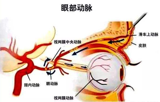 高血压|高血压是怎么一步步毁掉我们的？