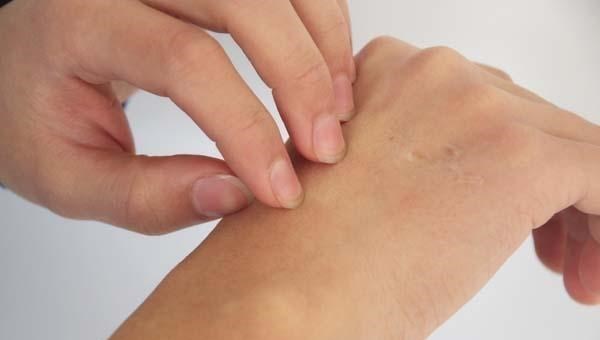 医生|肝功能差的5个信号，假如你有，哪怕只有一个，也要尽快去检查