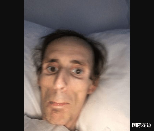 医生|爱尔兰谷歌员工把血癌当成“骨折后遗症”，医生称只其能再活1天