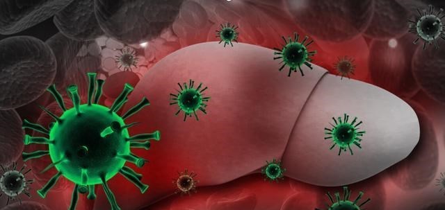 长寿|肝硬化多是“拖”出来，头部有4种“怪象”，肝或已硬如“磐石”