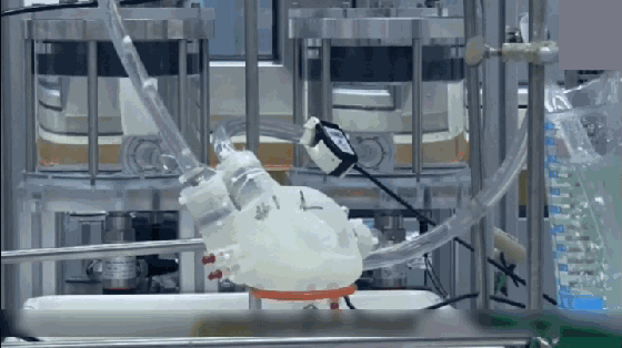 「狒狒」36年前移植狒狒心脏的那个女孩, 最后成功了, 她到底活了多久?