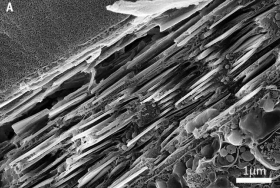 『科学家』扇贝有200多只眼睛,结构比人眼复杂,它们眼中的世界是怎样的