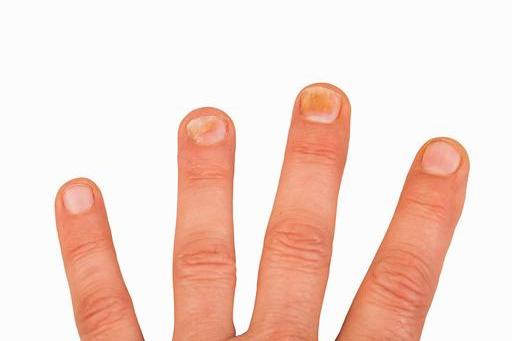 [心脏]总是睡不着、睡不好？身体在向你“暗示”三件事，不要硬撑了