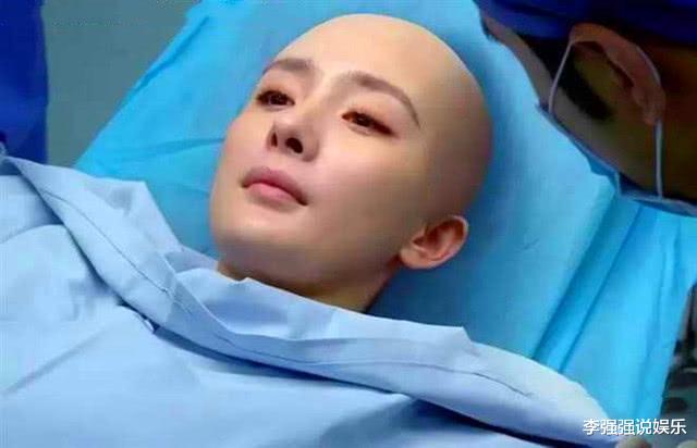 『郑爽』“丑不丑，看光头”，郑爽杨紫依旧漂亮，她简直是行走的卤蛋