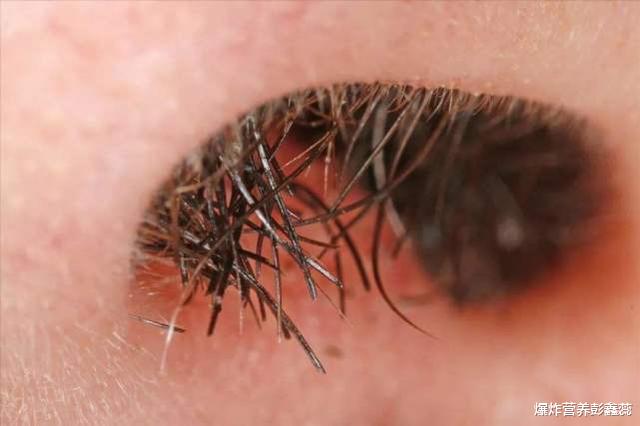 长寿|能不能长命百岁全写在脸上，寿命长的人都有4个共同点，你占多少