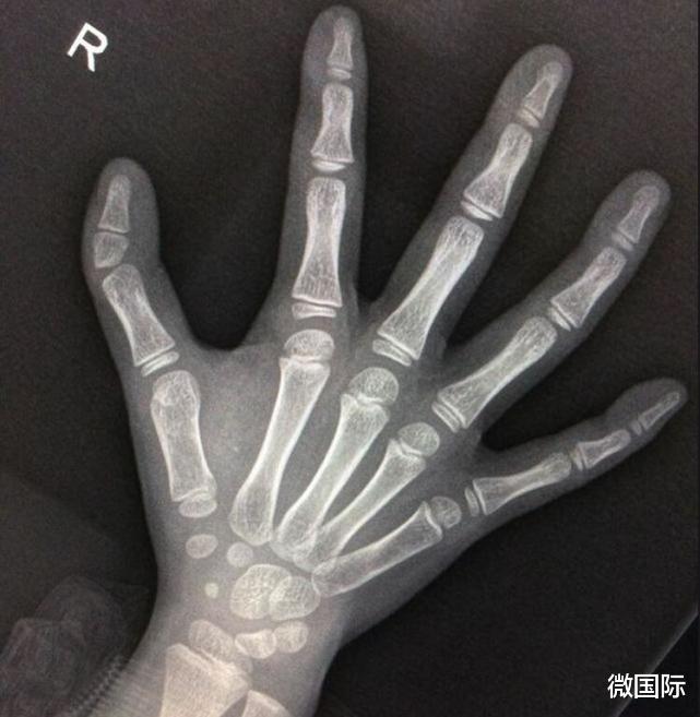 毒液|人类拥有5种“另类特征”，你有这些“特殊能力”？网友直呼神奇