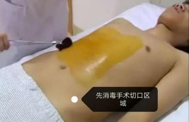 香坊@做个小手术,为什么却要脱光衣服和裤子?医生说出了真相
