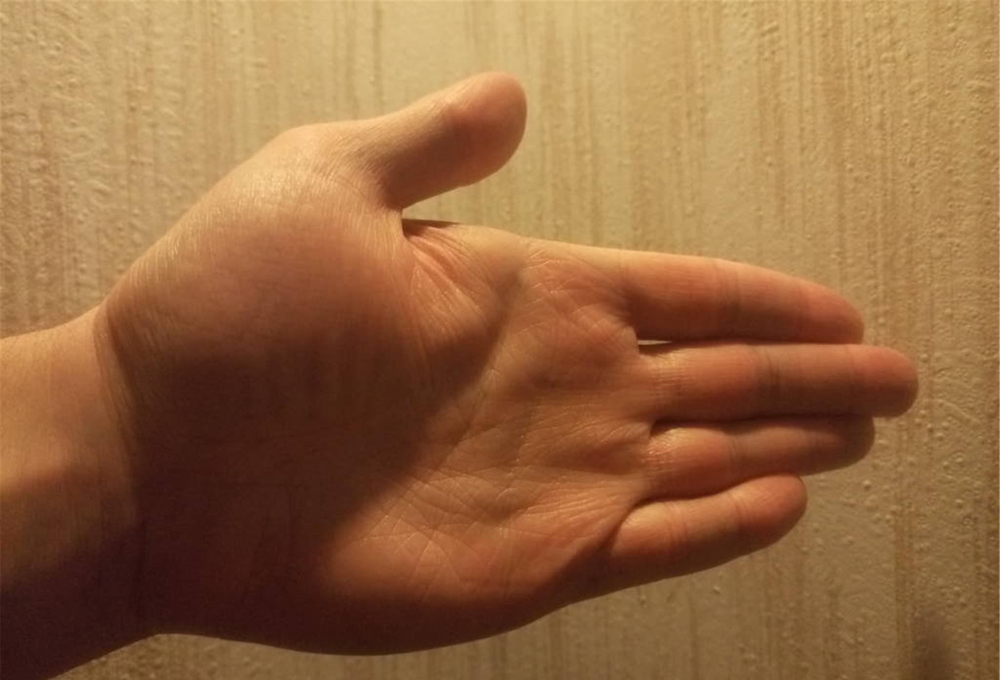 咳嗽|肺部发出的“控诉”信号，除了咳嗽还有这些，别再蒙鼓里了