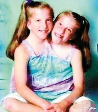 |长着“两个头”的蛇类——双头蛇,看上去可怕,却是个“战五渣”