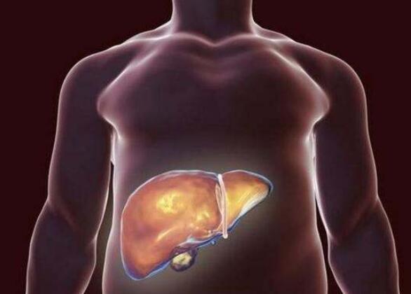 肝癌|43岁女子胸口出现“蜘蛛”，结果查出了肝癌晚期，医生：很可惜