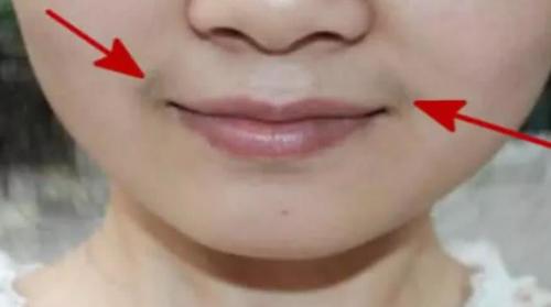 妇科疾病|女人是否有妇科病，看嘴就知道，健康的女性一般没有这4个异常