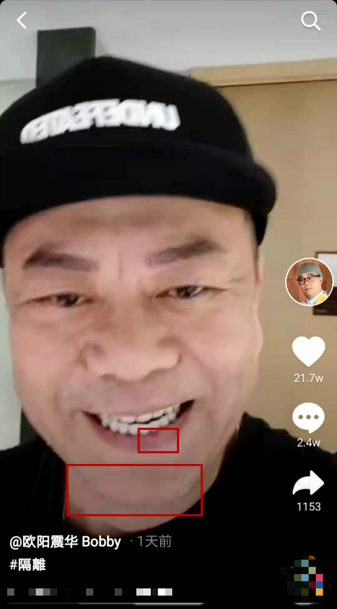张玮|欧阳震华嘴唇爆裂，娶赌王孙女却24年无子，希望妻子比他先死？