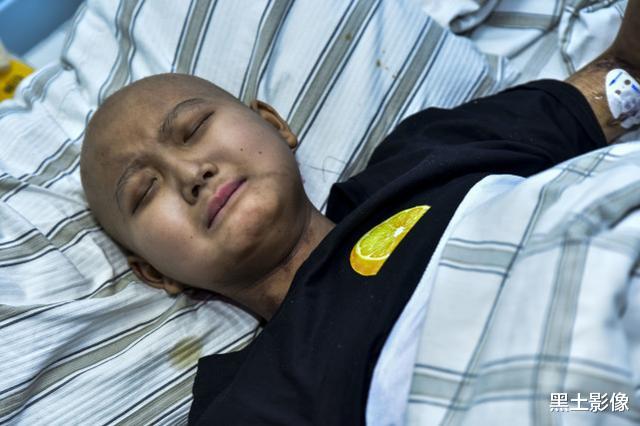 医生|花季少女住进医院后俏容颜变“黑大叔”，偷听医生谈话后留下遗言