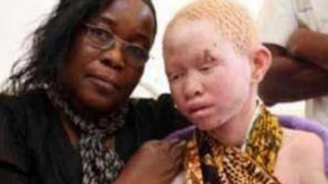 「非洲」非洲最精贵的人，被当“唐僧肉”，血液堪比黄金，24小时被保护！