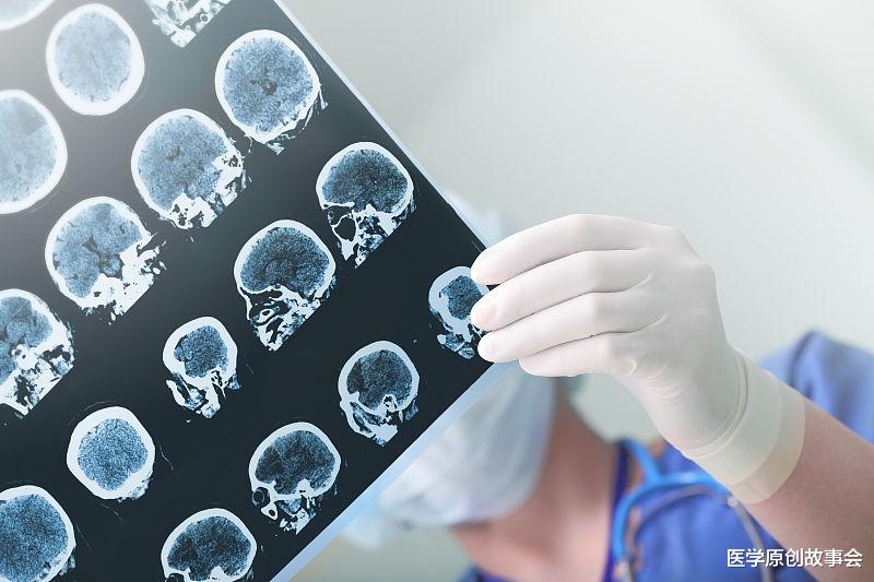 睡眠|血管开始狭窄，睡觉时有四个表现，超过两个以上，尽早去医院体检