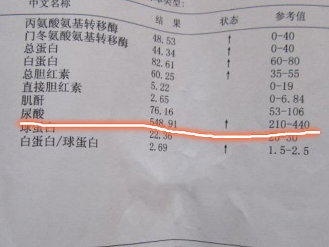 「」尿酸高的人,饭后坚持1个好习惯,尿酸准降回原点