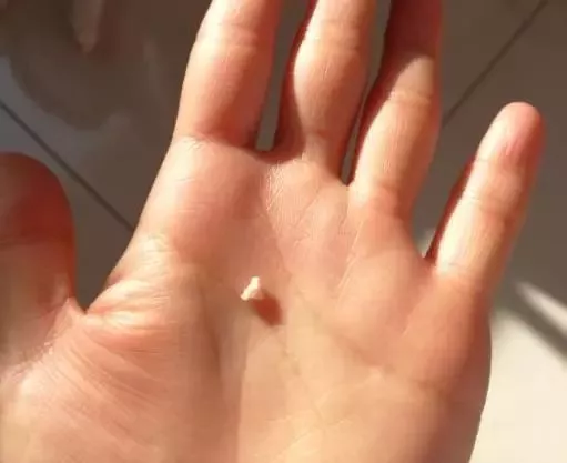 小猫咬主人手指后，看到从嘴里掉出一颗牙，突然就不淡定了