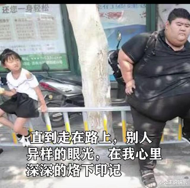 医生|励志！他是中国第一胖，为减肥切胃，并开始锻炼为爱减重400斤