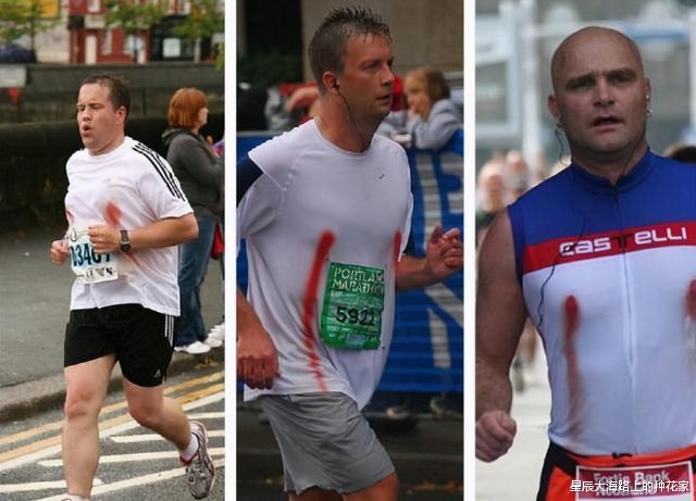 科学家|人类正在见证自己进化，科学家发现手臂长出新血管，颈部现新器官