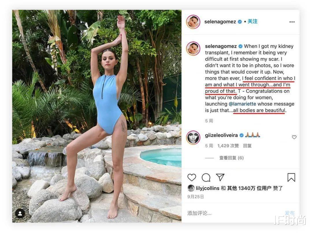 赛琳娜|患病抑郁的赛琳娜，终于又美回来了