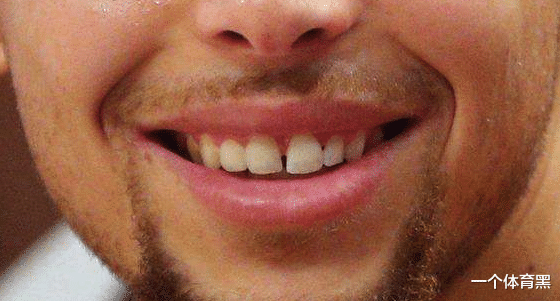 【凯文·杜兰特】老球迷测试：8位NBA球星只看嘴，你能认出几个？图3最容易误会