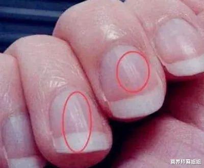 『肝脏』身体3处出现异常,是宣告肝脏已衰退,45岁后,6件伤肝事少做