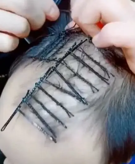 「烫发」男子秃头了还烫发，看到效果，网友：大叔变小鲜肉