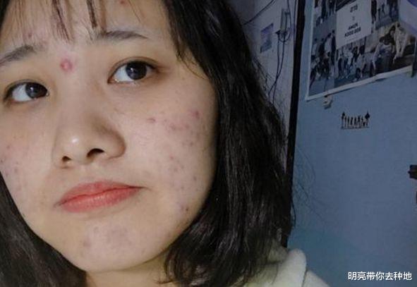 #莲子#女性皮肤黄气色差？常吃2种食物，肤色白皙、红润有光泽