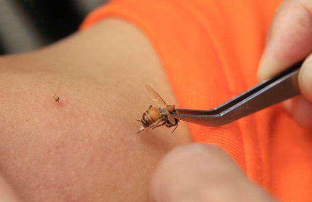 『』为什么蜜蜂在蜇完人后，会马上死去？看完解开多年的疑惑了