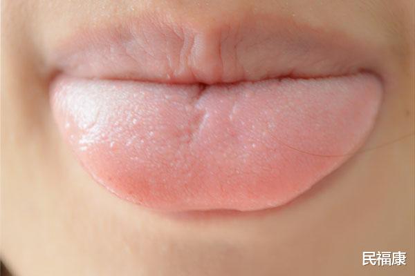 医生|吃饭总是咬到舌头，一查竟是舌癌？医生：原因有两个，要重视