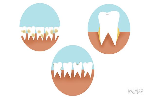 「饮食」乙肝变严重时，身体会给出哪些信号？乙肝患者日常应注意些什么？