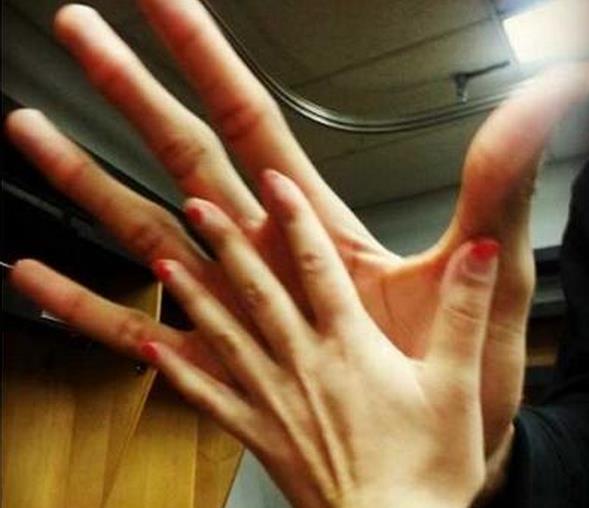 菲尔普斯■体坛3大有违正常生理结构的巨星，一人手长27cm，他的脖子比头粗