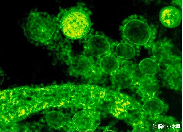 【微生物】人类体内共有380万亿多个病毒，为什么我们却活得好好的？