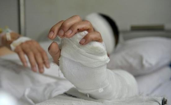 『』三年前用绷带瘦身的姑娘，现在变成啥样了？看完有点不相信！