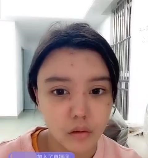 岳云鹏|韩安冉精神病院内再开播，百万整容脸已不成样子，恳请粉丝买面膜