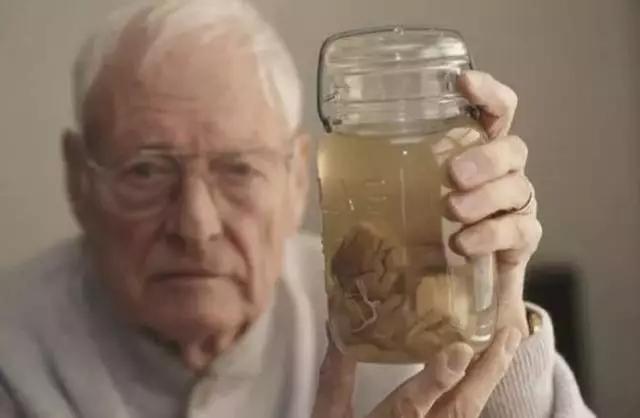 『爱因斯坦』最惊悚的收藏——名人器官，爱因斯坦大脑、肖邦心脏、伽利略手指