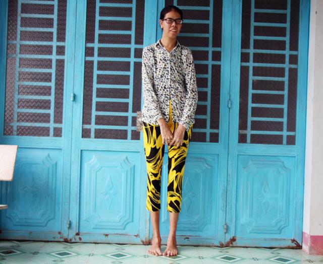 睹图|25岁女子出生时仅3.6斤，如今身高2米母亲担心她嫁不出去