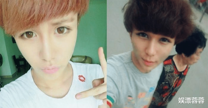 整容|?整容整毁了的5位明星红人， 正常人已无法欣赏你们的盛世美颜了！