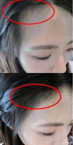 洗发水|电视曝光，已列入黑名单的洗发水你还在用？难怪头发一直掉！