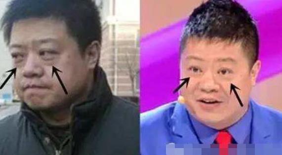 「眼霜」戚薇晒出的“万能”眼霜,价格一曝光,网友:我把兰蔻丢掉了