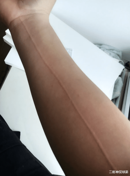 美甲|“脚趾被钢管砸了，有什么办法好的快？”哈哈哈新做的美甲？