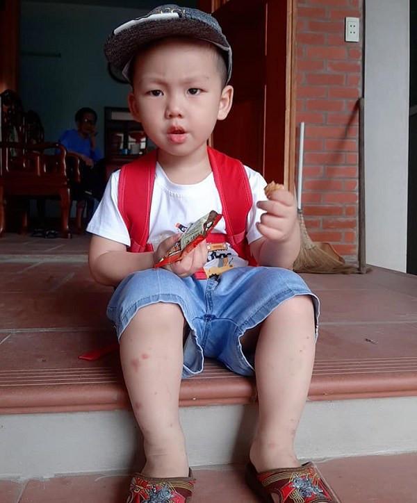 睹图|男孩出生时体重14.2斤吓坏家人，如今3岁的他变成什么样了