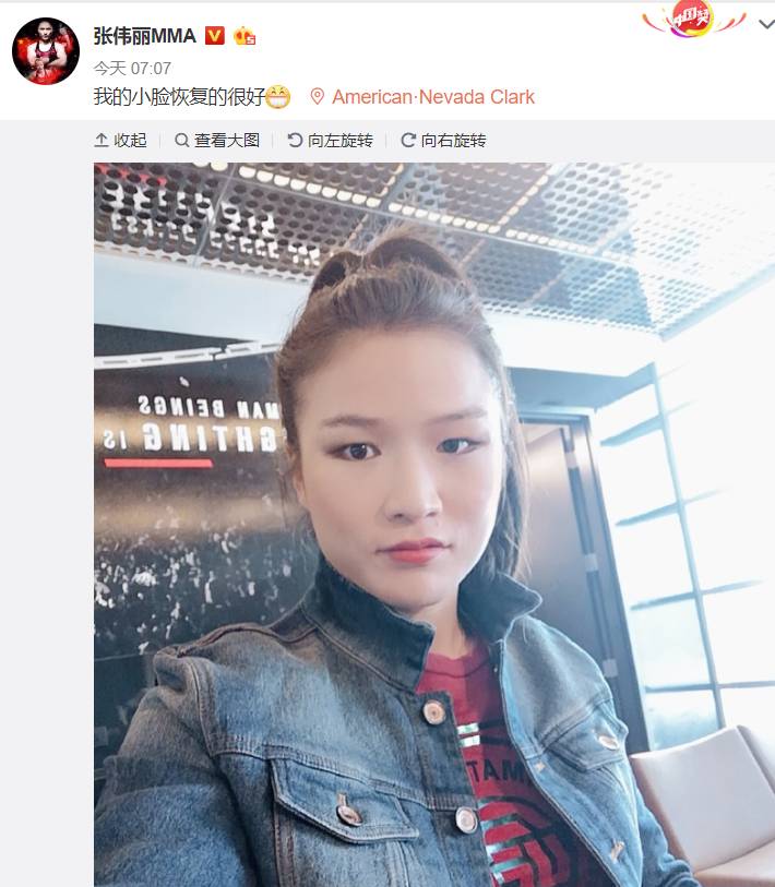 张伟丽@张伟丽晒自拍美颜照:我的小脸恢复的很好